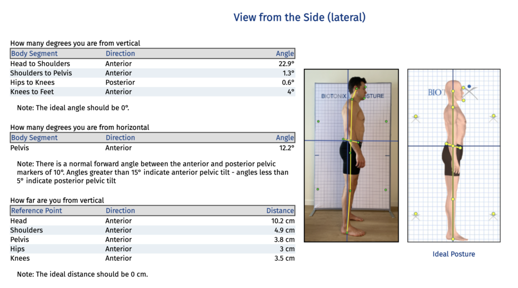 Illustration demonstrating proper posture vs. common postural imbalances